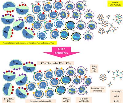 Deficiency of Human Adenosine Deaminase Type 2 – A Diagnostic Conundrum for the Hematologist